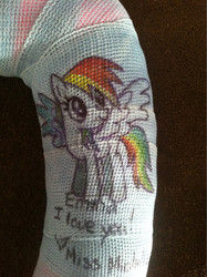 Size: 765x1024 | Tagged: source needed, safe, rainbow dash, g4, cast, injured, photo, traditional art