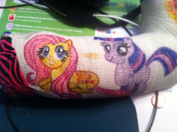 Size: 1024x765 | Tagged: safe, fluttershy, twilight sparkle, g4, cast, filly, injured, photo, traditional art