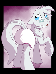 Size: 920x1217 | Tagged: safe, artist:bloodoodles, oc, oc only, pony, diaper, non-baby in diaper, solo