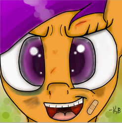 Size: 569x577 | Tagged: safe, artist:infinitussketch, scootaloo, pony, g4, bandage, black eye, blood, bruised, female, portrait, solo