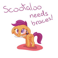 Size: 1000x1000 | Tagged: safe, artist:ponygoggles, scootaloo, g4, braces, cute, cutealoo, dental plan, female, male, simpsons did it, solo, the simpsons