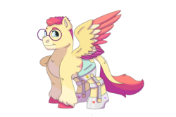Size: 1095x730 | Tagged: safe, artist:itstechtock, oc, oc only, oc:stage canary, pegasus, pony, glasses, leg brace, male, simple background, solo, stallion, transparent background
