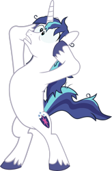 Size: 1984x3023 | Tagged: safe, artist:outlawquadrant, screencap, shining armor, pony, unicorn, g4, the crystalling, bipedal, cracked armor, crazy face, faic, hooves on face, male, messy hair, on hind legs, simple background, solo, transparent background