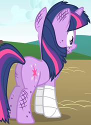 Size: 1064x1461 | Tagged: safe, screencap, twilight sparkle, pony, unicorn, feeling pinkie keen, g4, season 1, butt, dirty, female, injured, mare, plot, solo, twibutt, unicorn twilight